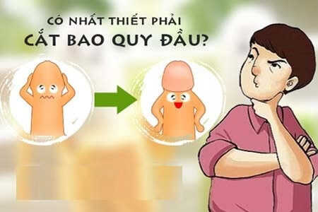 Bao quy đầu dài có nên cắt không?
